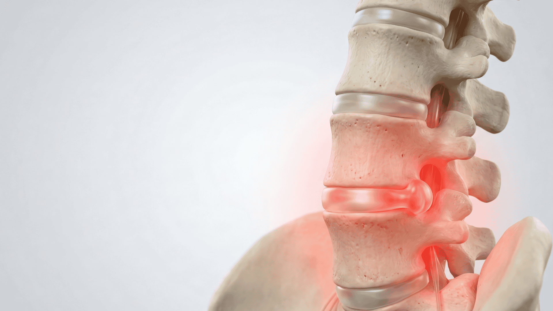 Cervical Vertebral Osteoarthritis - Find Lasting Relief