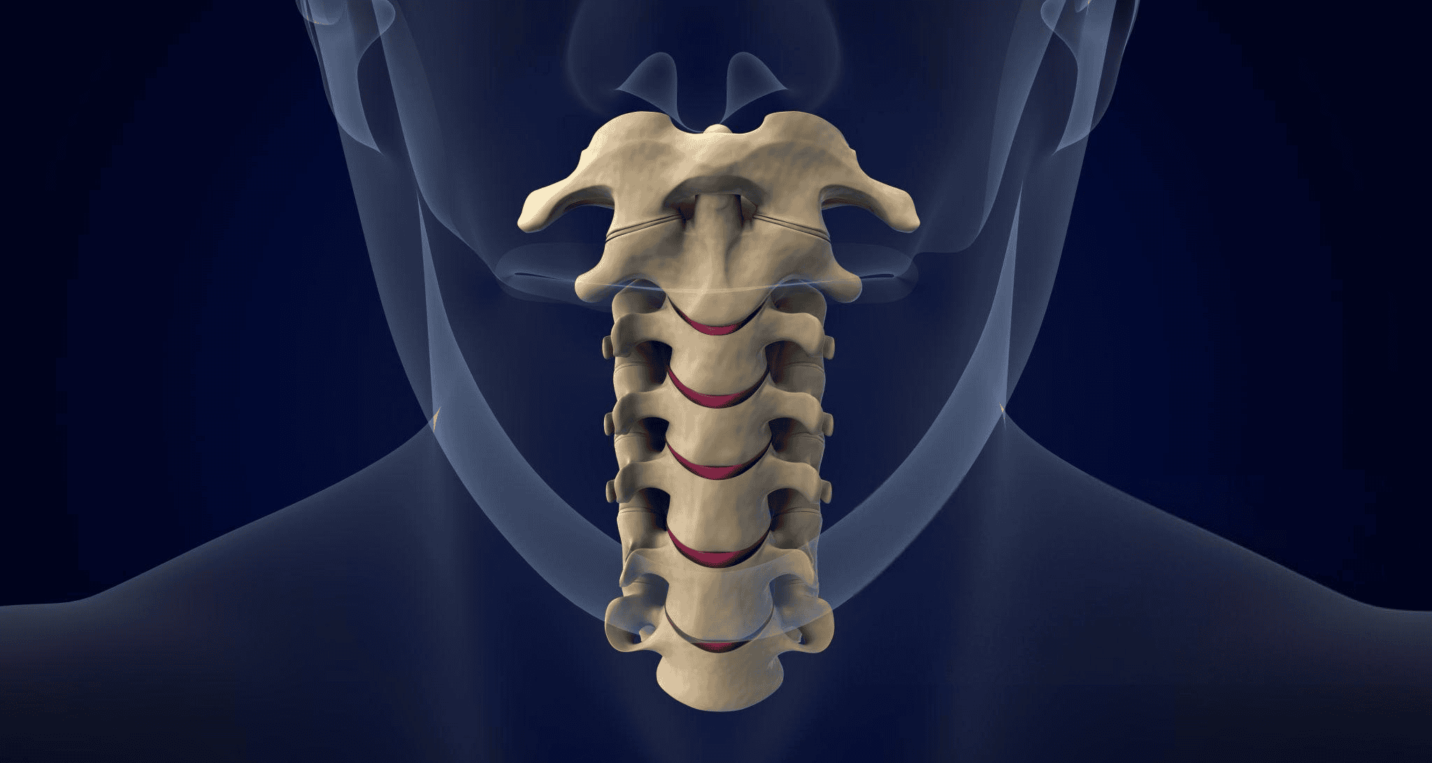 Cervical Decompression Surgery - Relieve Spinal Pressure