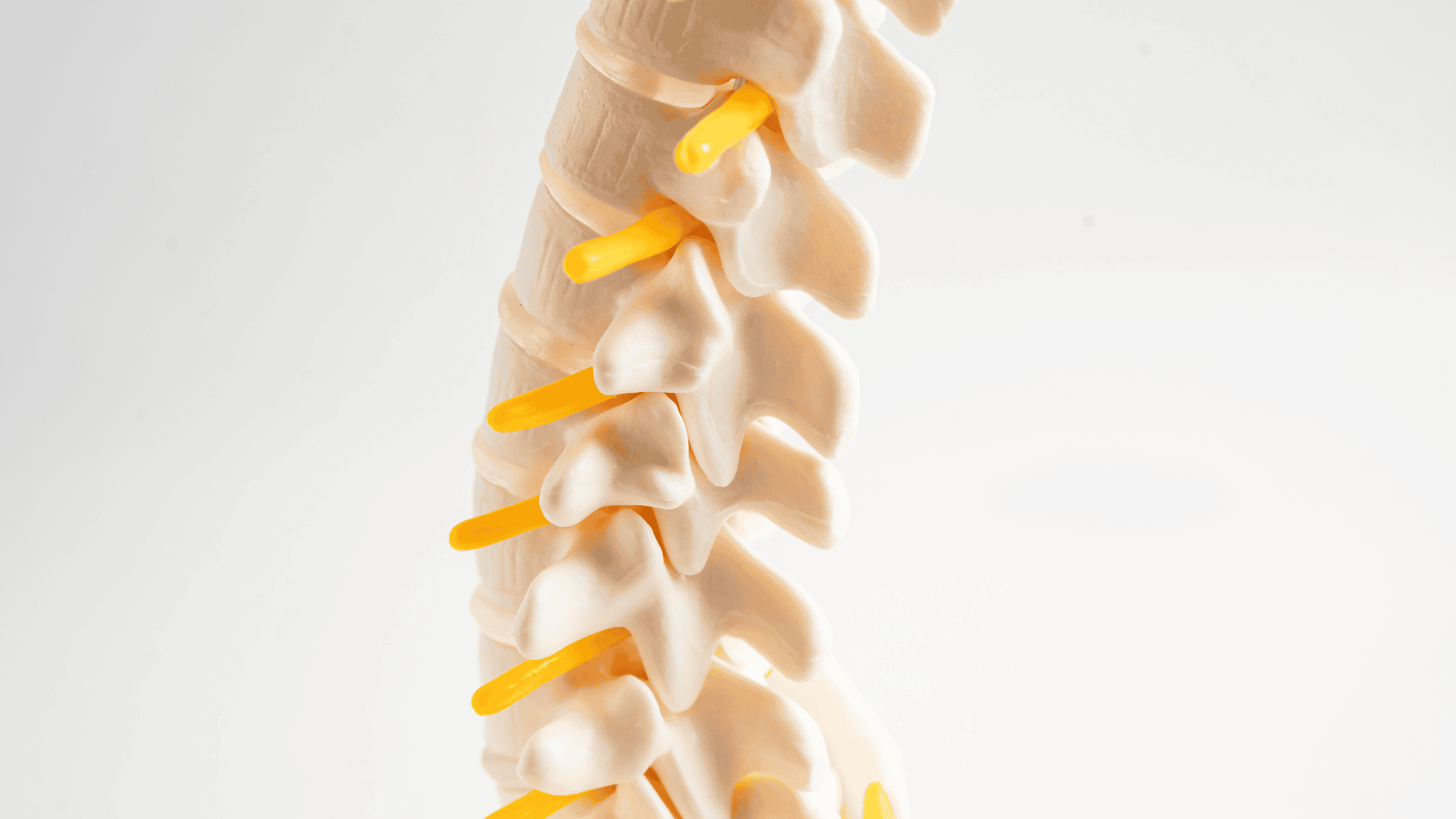 Cervical Disc Herniation Treatment by Wascher Cervical Spine Institute 2