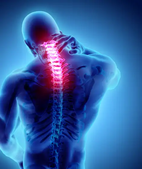 Cervical Foraminal Stenosis - Wascher Cervical Spine Institute