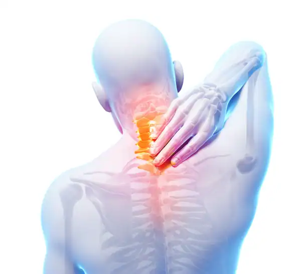 Pseudarthrosis - When Spinal Fusion Fails, We Can Help
