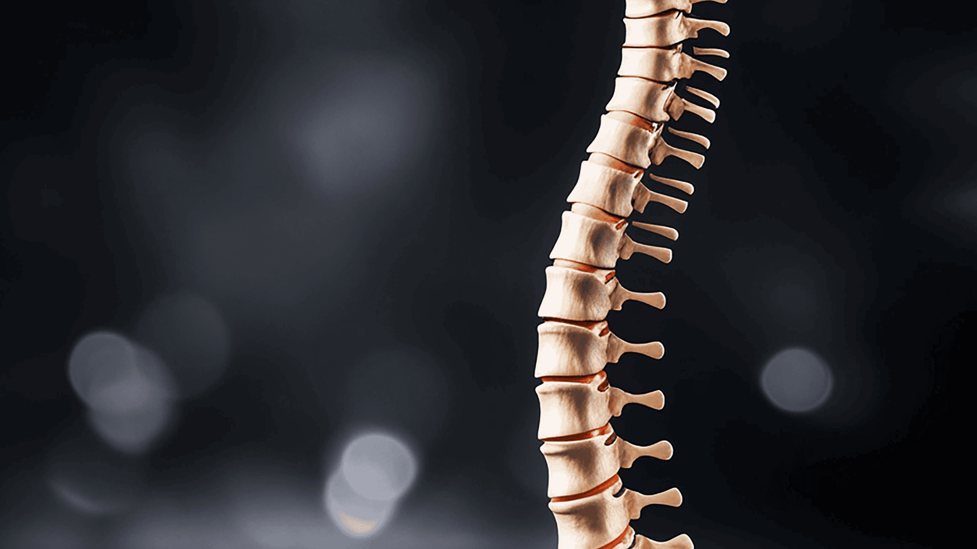 Spinal Decompression | Wascher Cervical Spine Institute