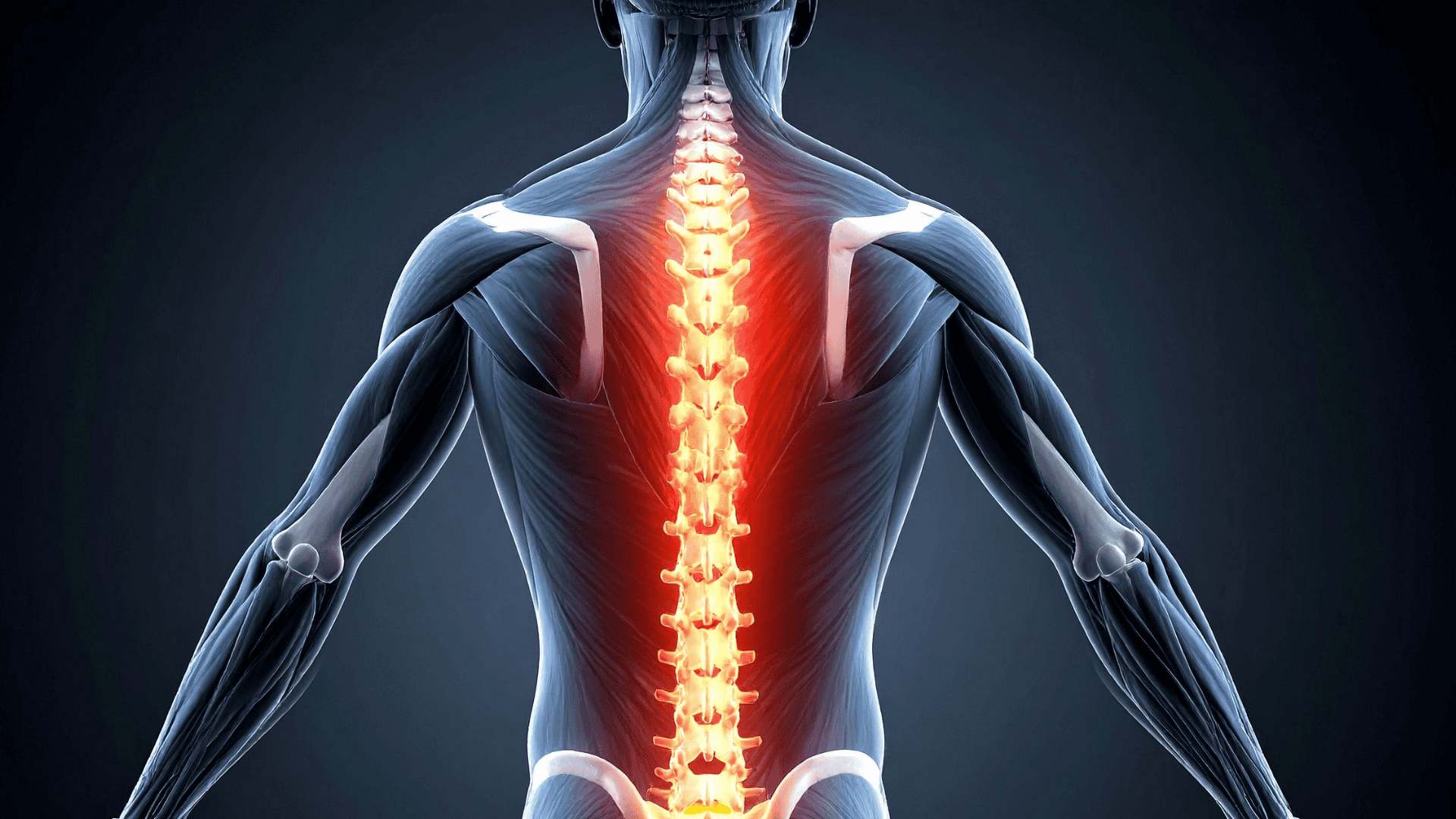 Anterior Cervical Decompression | Wascher Cervical Spine Institute 2