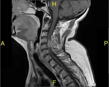 VLCSC Case Study 1 - Wascher Cervical Spine Institute