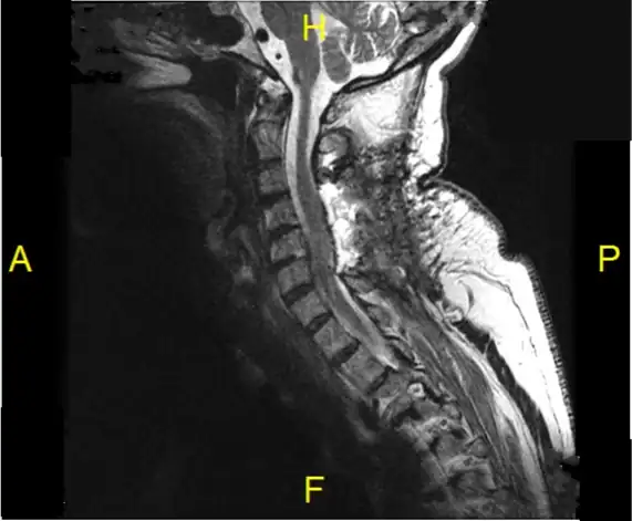 VLCSC Case Study 2 - Wascher Cervical Spine Institute