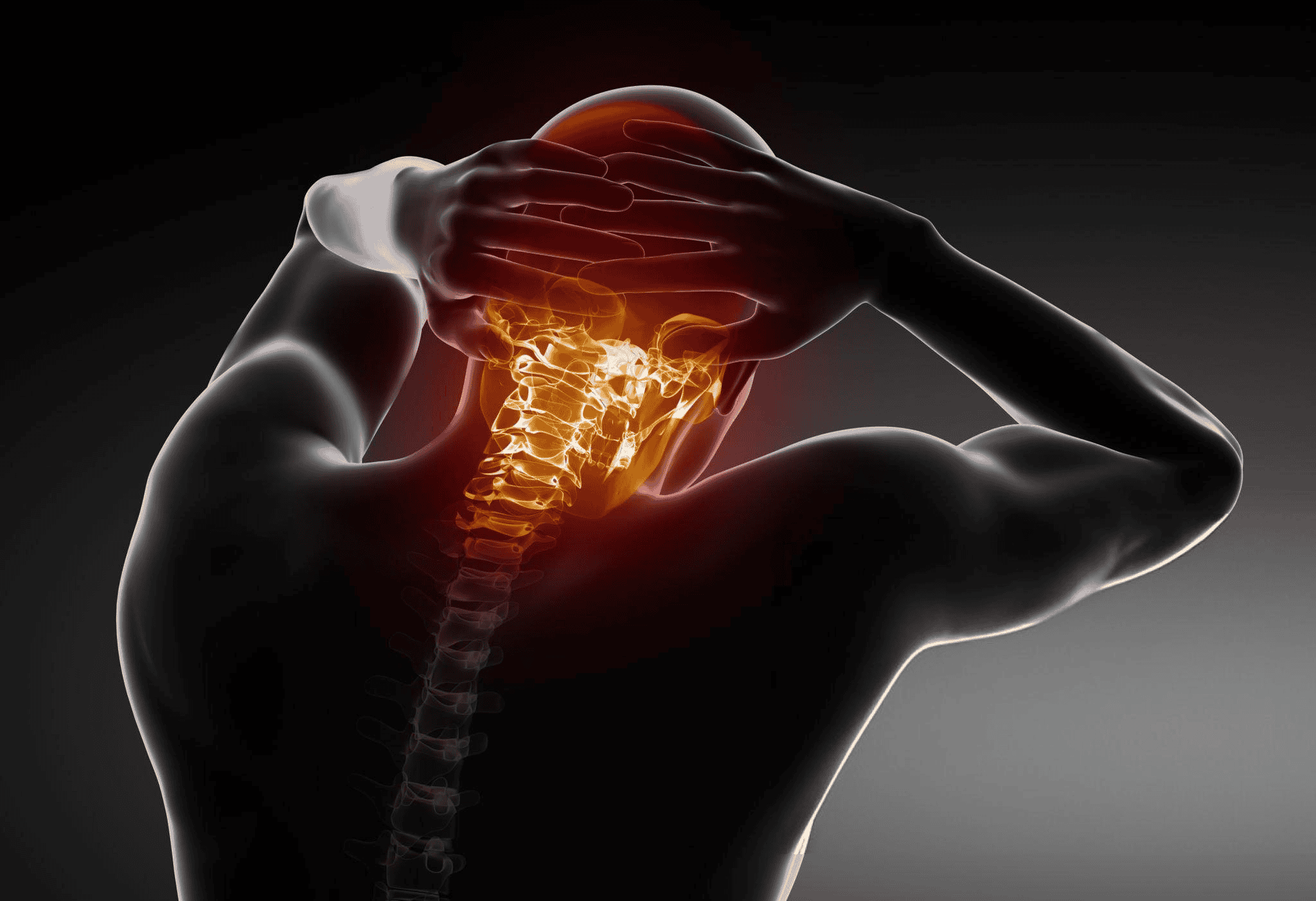 Anterior Cervical Corpectomy | Wascher Cervical Spine Institute